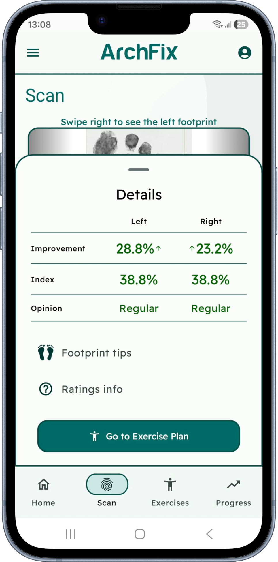 AI-driven footprint analysis for pediatric posture