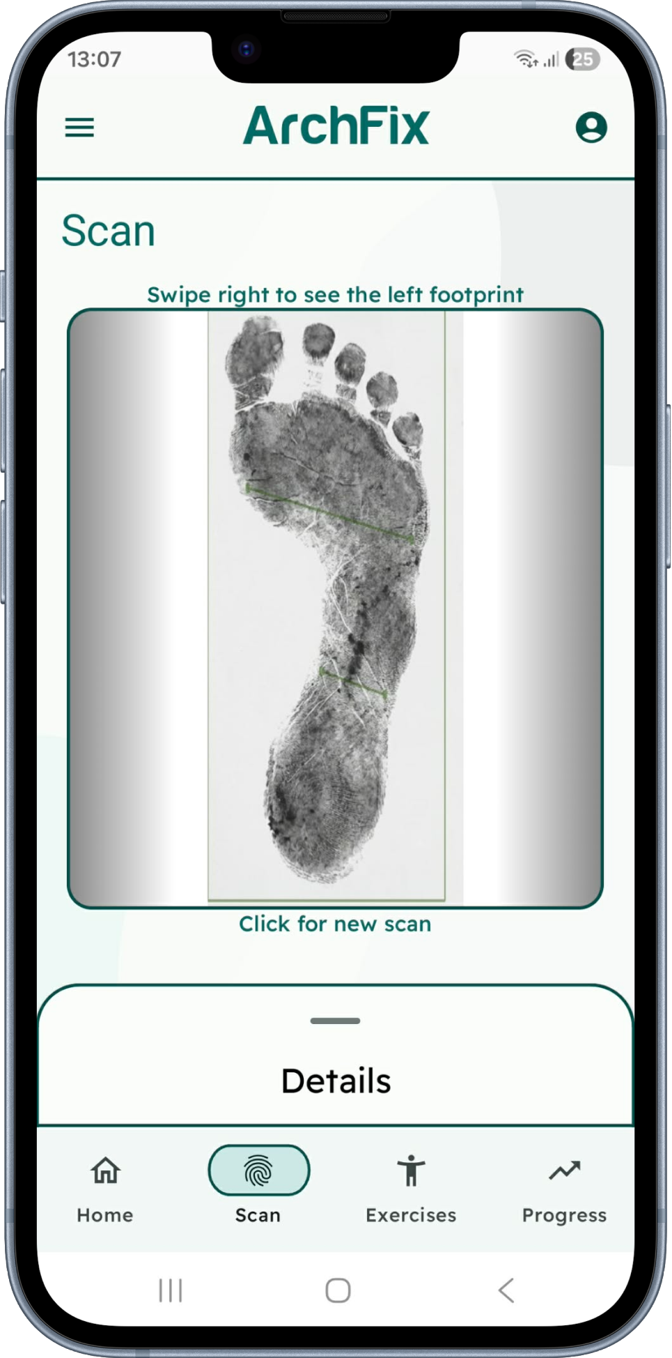 ArchFix AI footprint scan for children's flat feet